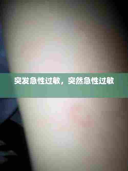 突发急性过敏,突然急性过敏