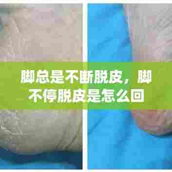 脚总是不断脱皮，脚不停脱皮是怎么回事 