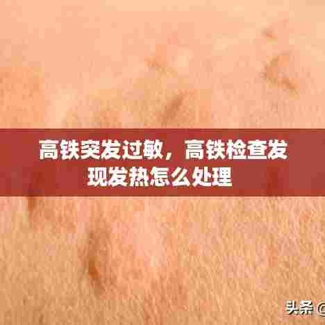 高铁突发过敏，高铁检查发现发热怎么处理 