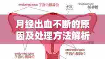月经出血不断的原因及处理方法解析