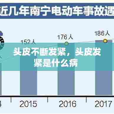 头皮不断发紧，头皮发紧是什么病 