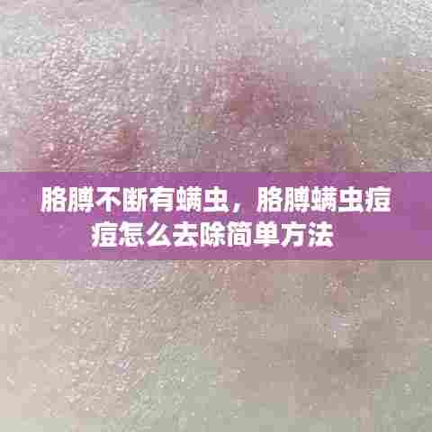 胳膊不断有螨虫，胳膊螨虫痘痘怎么去除简单方法 