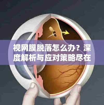 视网膜脱落怎么办？深度解析与应对策略尽在希玛眼科