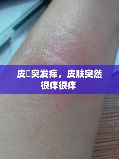 皮膚突发痒，皮肤突然很痒很痒 