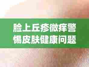 脸上丘疹微痒警惕皮肤健康问题，不容忽视！