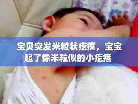 宝贝突发米粒状疙瘩,宝宝起了像米粒似的小疙瘩
