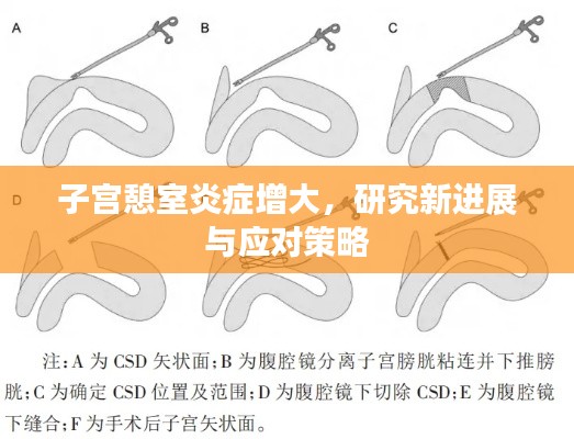 子宫憩室炎症增大，研究新进展与应对策略