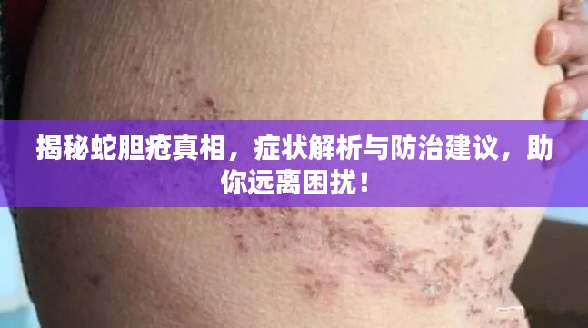 揭秘蛇胆疮真相，症状解析与防治建议，助你远离困扰！