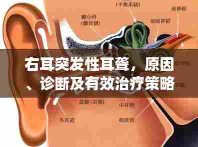 右耳突发性耳聋，原因、诊断及有效治疗策略