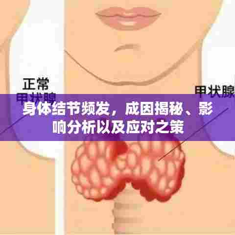 身体结节频发,成因揭秘、影响分析以及应对之策